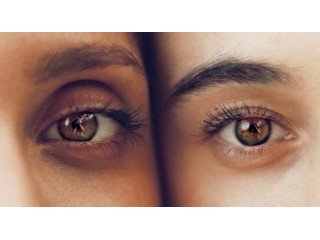 "Зоротекс" і "Орлемікс" — природний захист Ваших очей